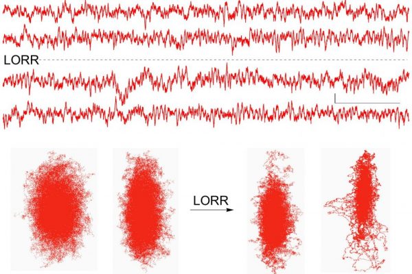 rat12_lorr_eeg_chaos